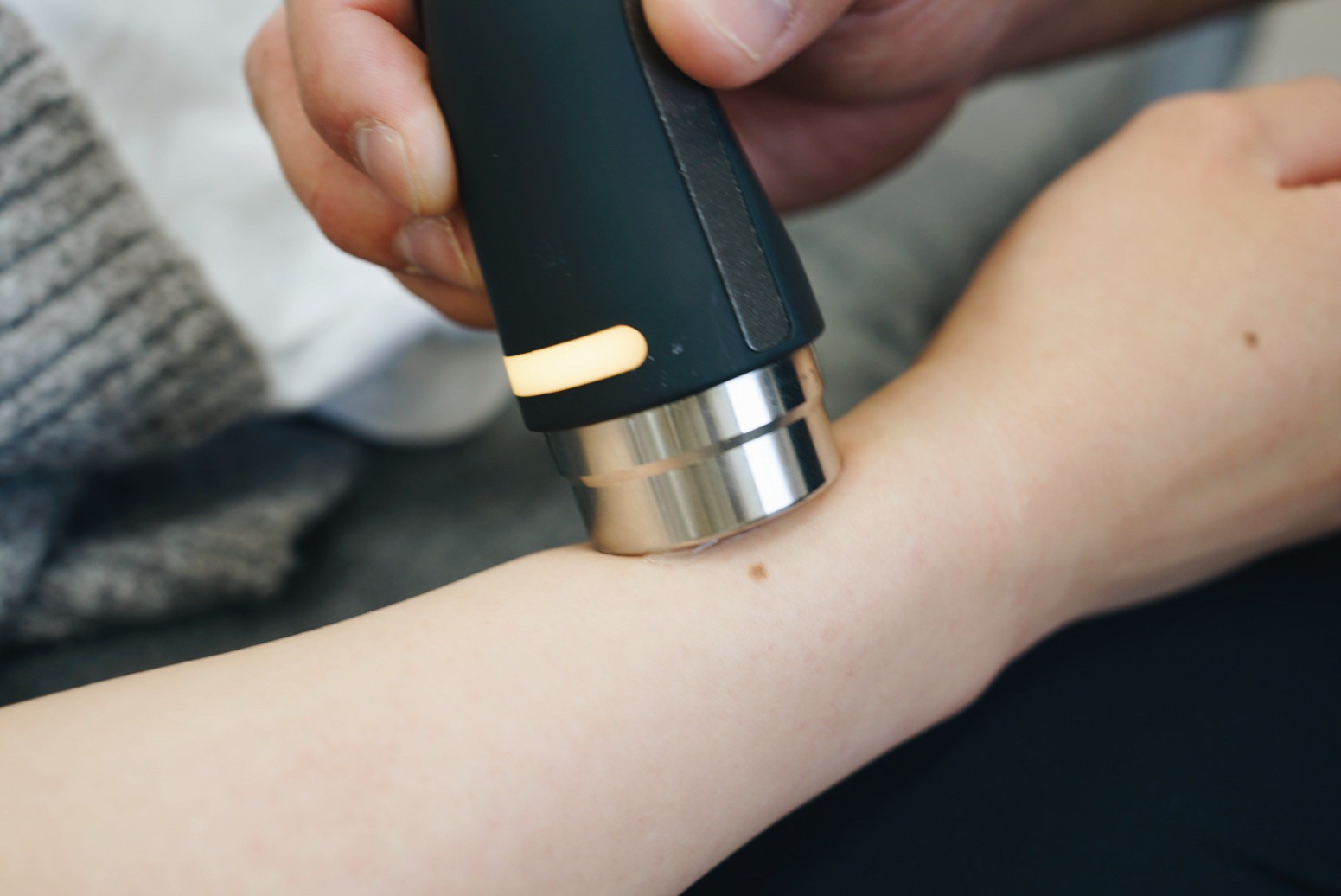 高崎市在住20代女性の母指腱鞘炎（ドケルバン病）