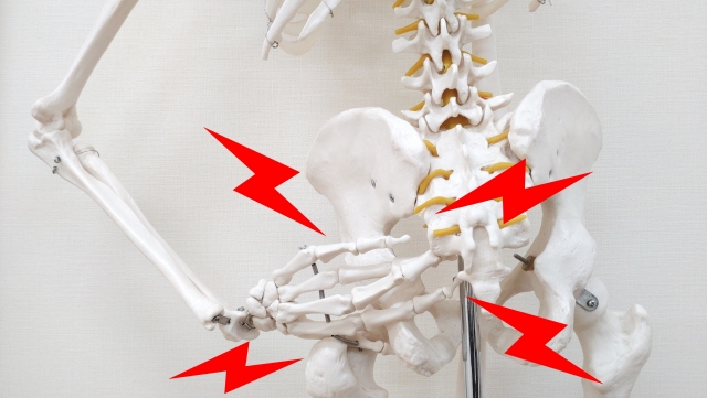 お尻の痛みがある骨模型